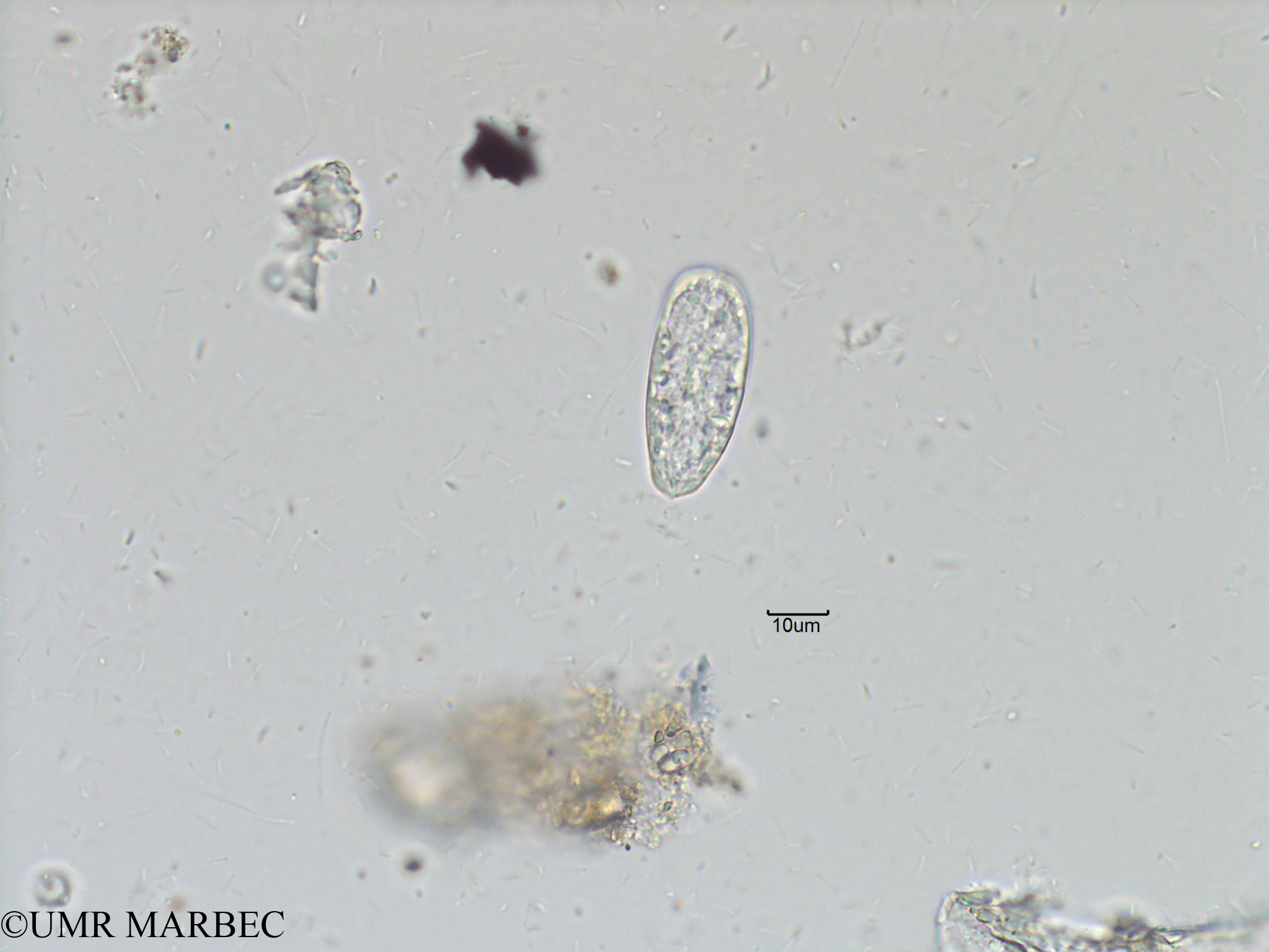 phyto/Bizerte/bizerte_bay/RISCO November 2015/Prorocentrum dactylus (Baie_T5-ACW3-Prorocentrum c lequel-3).tif(copy).jpg